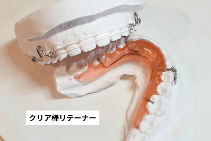 クリア棒リテーナー