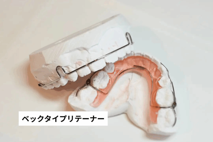 ベックタイプリテーナー