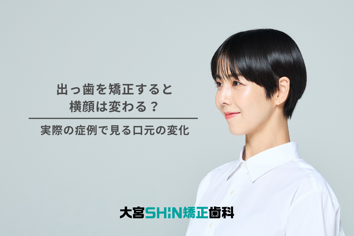 出っ歯、矯正、横顔