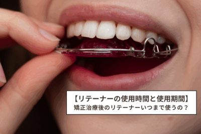 リテーナーの使用時間と使用期間】矯正治療後のリテーナーはいつまで
