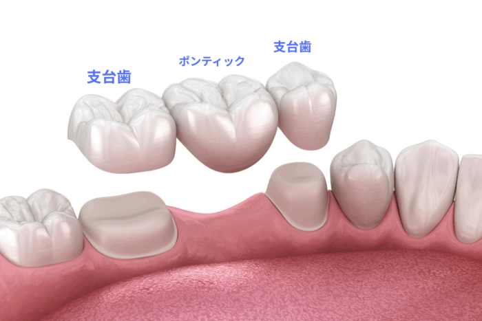 ブリッジの構成