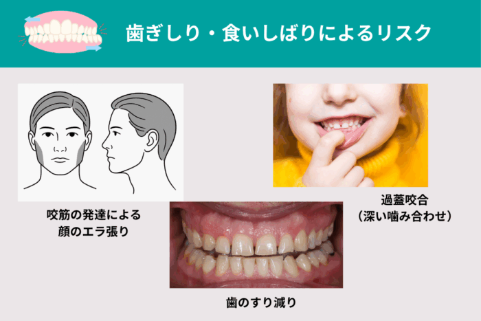 歯ぎしり・食いしばりによる見た目のリスク