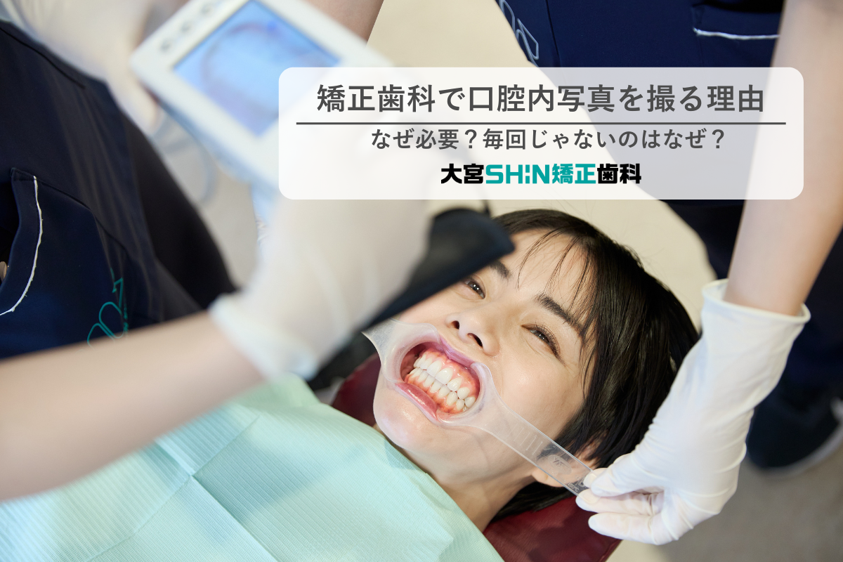 矯正歯科　口腔内写真